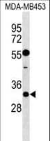 KCNIP2 / KCHIP2 Antibody (aa50-78)