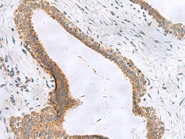 Polyclonal Rabbit anti-Human CEMIP / KIAA1199 Antibody (IHC)