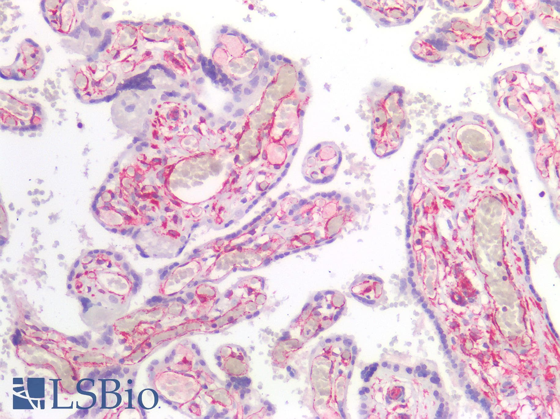 PathPlus™ Vimentin Antibody (clone RV202)