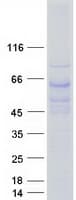 Human TBL1X / TBL1 Protein (Recombinant Myc-DDK (Flag))