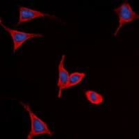 FZD9 / Frizzled 9 Antibody (C-Terminus)