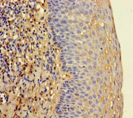 Polyclonal Rabbit anti-Human RNASEL / RNase L Antibody (WB)