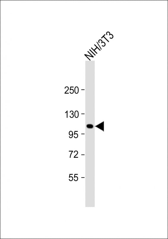 Polyclonal Rabbit anti-Human GLI / GLI1 Antibody (aa196-230, WB)