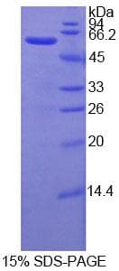 Human SELL / L-Selectin / CD62L Protein (Recombinant His-GST)