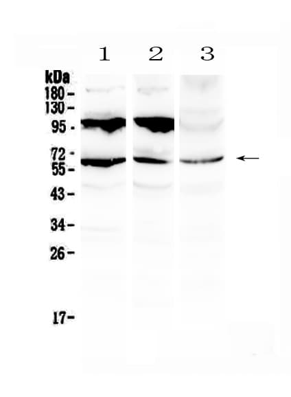 PLIN1 / Perilipin Antibody