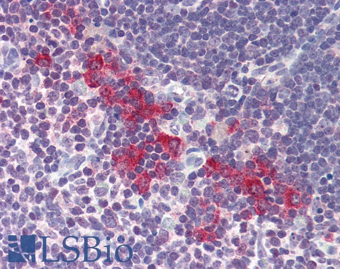 IHC-plus™ DNASE2 / DNase II Antibody