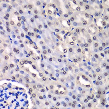 HNRPM / HNRNPM Antibody