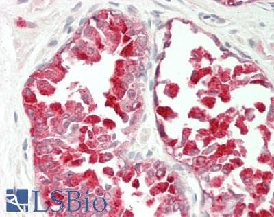 IHC-plus™ DSG4 / Desmoglein 4 Antibody (Internal)