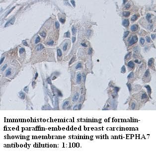 Polyclonal Rabbit anti-Human EPHA7 / EPH Receptor A7 Antibody (C-Terminus, IHC)