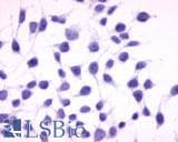 IHC-plus™ GPRC5A / RAI3 Antibody (Extracellular Domain)