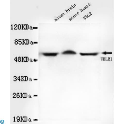 TBL1XR1 / TBLR1 Antibody
