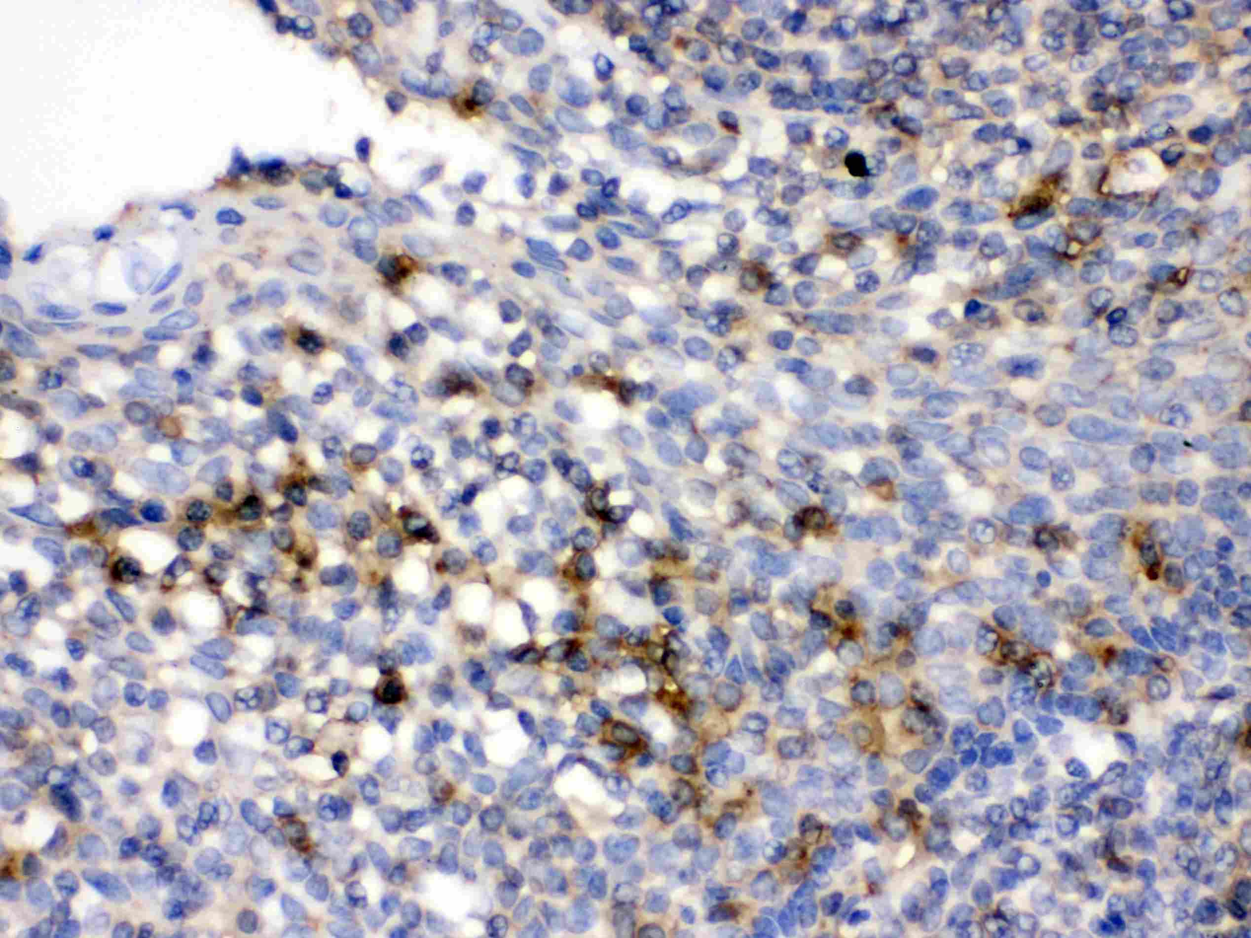 CD33 Antibody