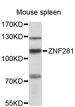 ZNF281 / Zfp281 Antibody