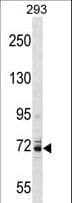 KCNC4 / Kv3.4 Antibody (aa518-546)