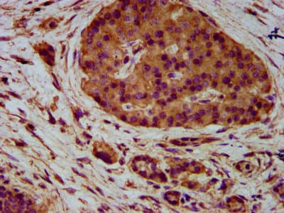 PVRL4 / Nectin 4 Antibody