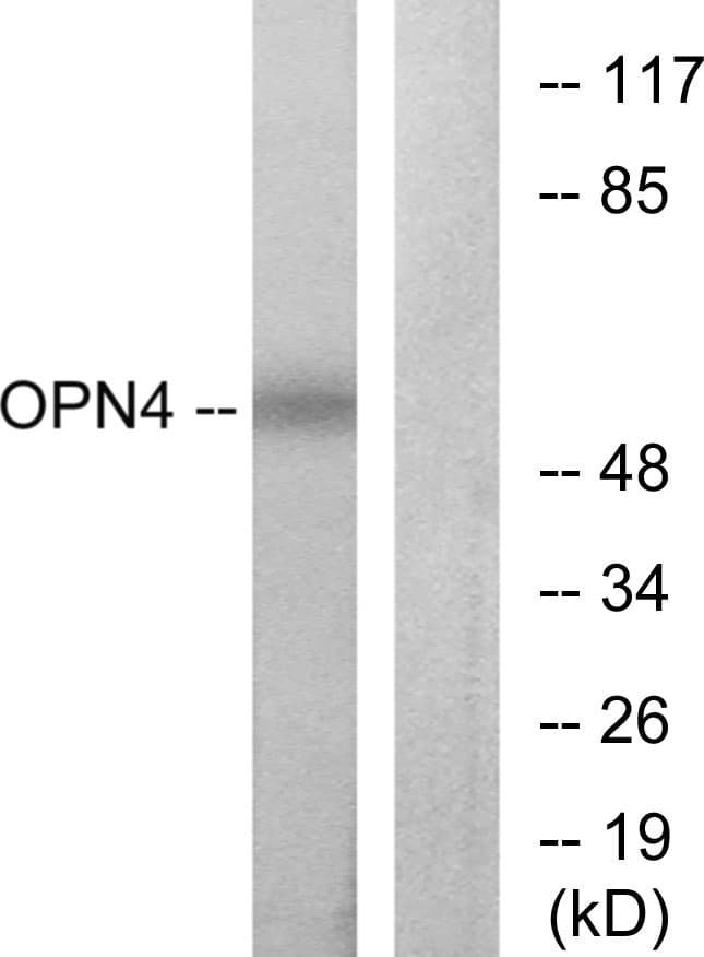 OPN4 / Melanopsin Antibody (aa429-478)