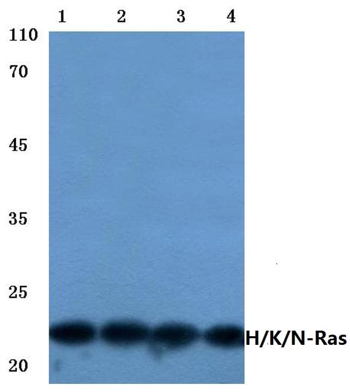 IHC-plus™ Polyclonal Rabbit anti-Human Ras (H, K, N) Antibody (aa1-50, IHC, WB)