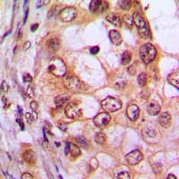CDKL1 Antibody (C-Terminus)