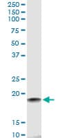 IHC-plus™ Monoclonal Mouse anti-Human HSPB7 / CvHSP Antibody (clone 3E11, IHC, WB)