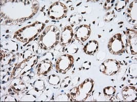 ERIC-1 / TACC3 Antibody (clone OTI1E8)