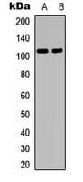 Polyclonal Rabbit anti-Human MYBL2 Antibody (C-Terminus, IF, WB)