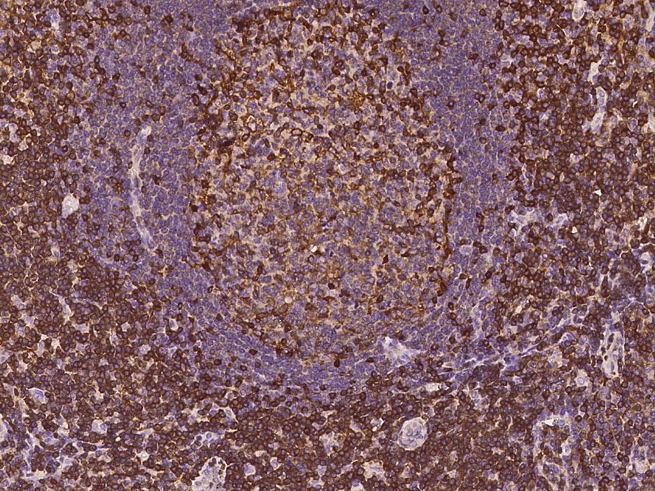 ADAP / FYB Antibody