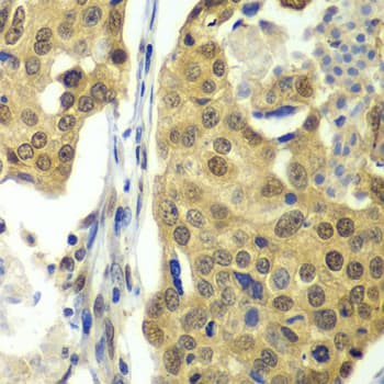 Polyclonal Rabbit anti-Human DDX1 Antibody (IHC, IF, WB)