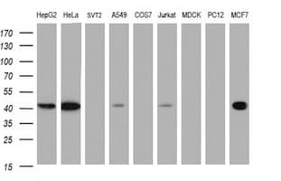 TBCC Antibody (clone OTI1F2)
