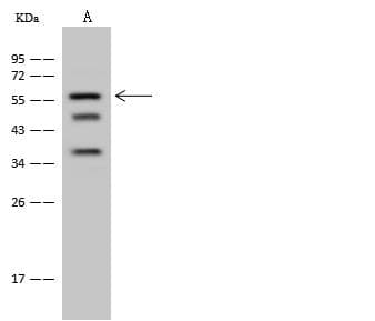 GPATCH2 Antibody