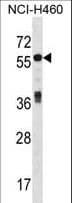 ICA69 / ICA1 Antibody (aa84-111)