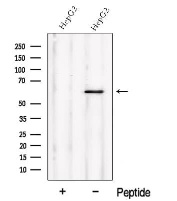 Polyclonal Rabbit anti-Human NMD3 Antibody (WB)