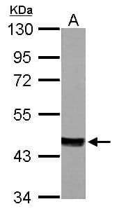 MVD Antibody (aa156-371)