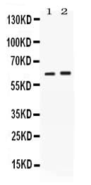 SCTR / SR / Secretin Receptor Antibody