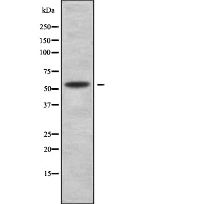 SERPINF2 / Alpha-2-Antiplasmin Antibody