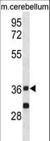 PP2Ac / PPP2CA Antibody (aa88-116)