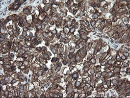 PDIA3 / ERp57 Antibody (aa140-505, clone OTI4D7)