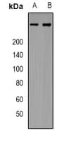 ITPR1 / IP3 Receptor Type 1 Antibody (Internal)