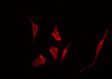 Polyclonal Rabbit anti-Human LPAR2 / EDG4 Antibody (IF, WB)