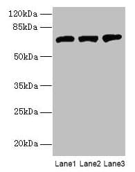 Polyclonal Rabbit anti-Human SWAP70 Antibody (WB)