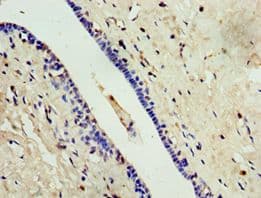 Polyclonal Rabbit anti-Human ALG1 Antibody (aa215-464, IHC)