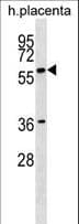 GAB3 Antibody (aa30-58)
