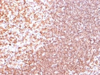 CD74 / CLIP Antibody (clone SPM523)