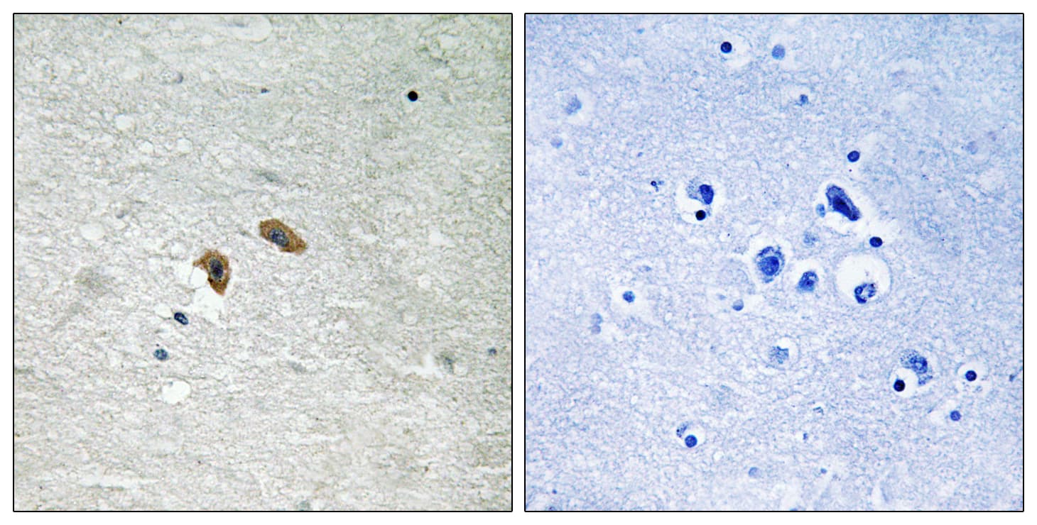RAF1 / RAF Antibody (phospho-Thr269)