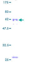 Human CYB5R3 / B5R Protein (Recombinant GST)