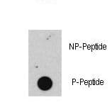 RB1 / Retinoblastoma / RB Antibody (phospho-Ser608)