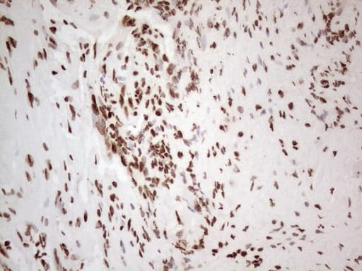 Monoclonal Mouse anti-Human HNRNPL / hnRNP L Antibody (clone OTI4E5, aa270-502, IHC)