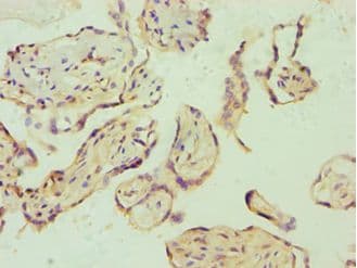 E2F6 Antibody (aa1-281)