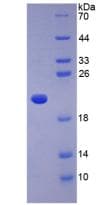 Human Adiponectin Protein (Recombinant His-S)