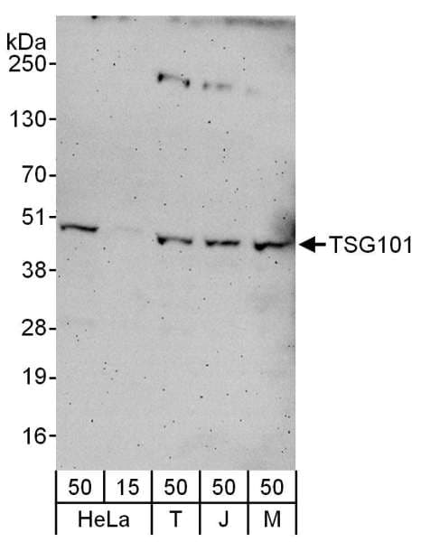 Polyclonal Rabbit anti-Human TSG101 Antibody (aa300-350, WB)