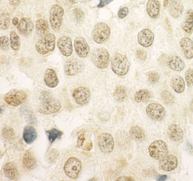 PRCC / RCCP1 Antibody (aa125-175)